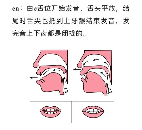 儿童语言障碍的发音训练