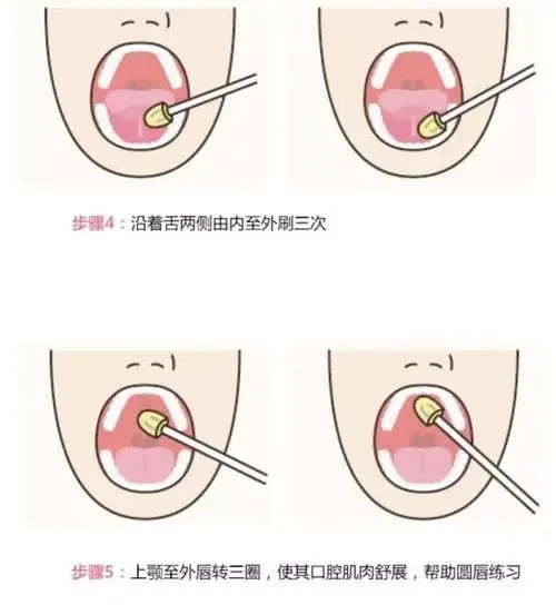 儿童语言障碍的发音训练
